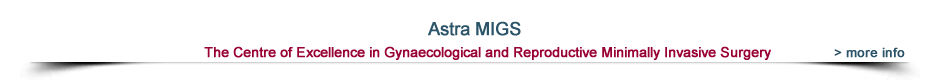 astra migs